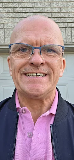 Before whitening