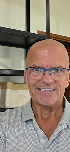 After whitening